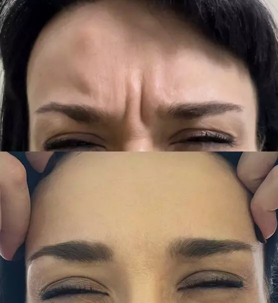 Қараңдаршы иіске